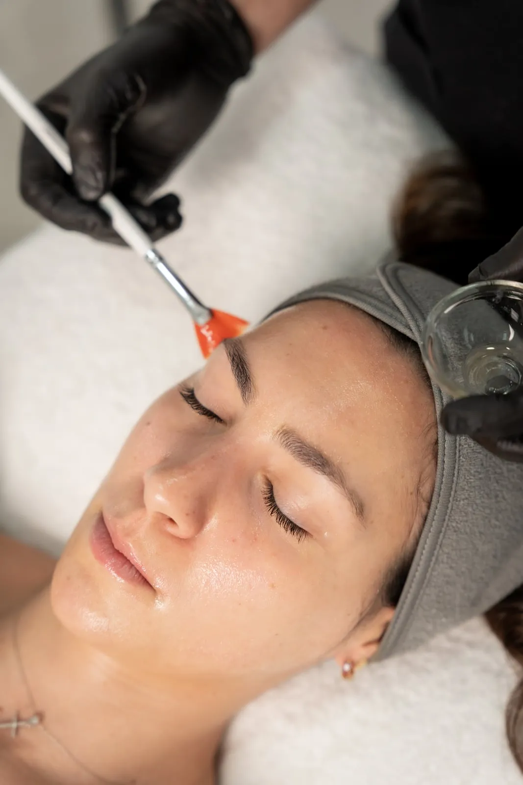 Aplicação de peeling químico na clínica